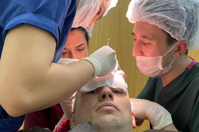 The former Leeds Rhinos player was back on the field three days after undergoing a seven hour hair transplant operation. Picture: Shaun Lunt/SWNS
