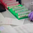 Samples are tested for respiratory viruses, which procedure will be used to test the coronavirus COVID-19,  (Photo by DANNY LAWSON/POOL/AFP via Getty Images)