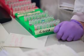 Samples are tested for respiratory viruses, which procedure will be used to test the coronavirus COVID-19,  (Photo by DANNY LAWSON/POOL/AFP via Getty Images)