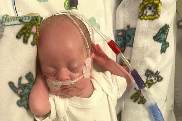 Baby Niamh was described as a 'medical miracle' after being born at 24 weeks
