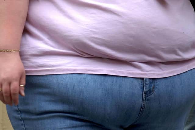 Cleckheaton has been identified as an obesity and deprivation hotspot