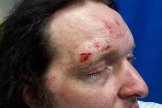 Phillip Steveris was beaten on his way home from a night out in Dewsbury.