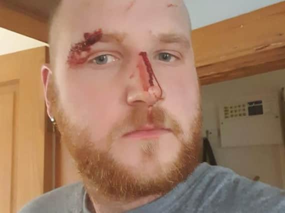 Stephen Brook, 27, of Liversedge, was attacked by a man with a screwdriver on Saturday.