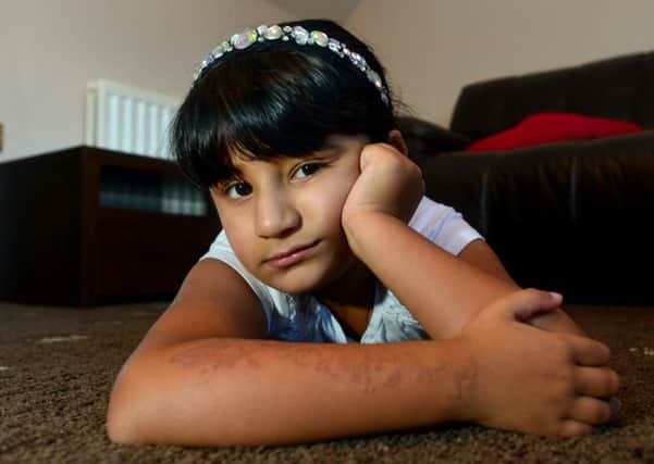 NEVER AGAIN Sanah Younis, 7, now has scarring on her arms after a black henna tattoo.