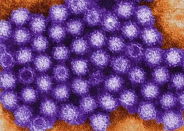 Norovirus can be very unpleasant but it usually clears up by itself in a few days.